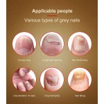 1PCS Nail Fungal Treatment Feet Care Essence Nail Foot Whitening Toe Nail Fungus Removal Gel Anti Infection Paronychia Onychomycosis
