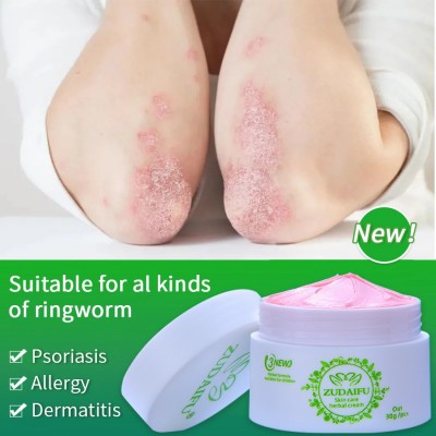 3PCS New ZUDAIFU Upgrade 30g Body Psoriasis Cream Skin Care Eczema